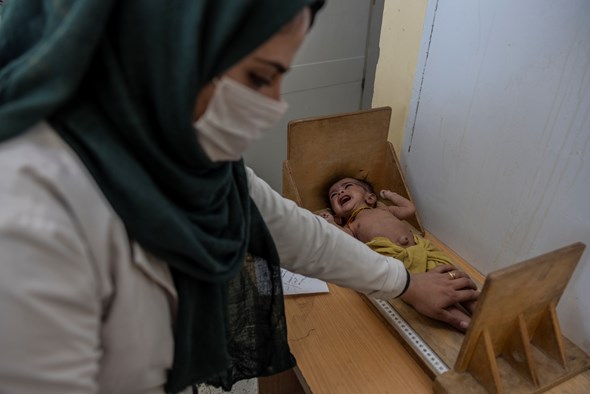Sykepleier behandler et underernært barn i Afghanistan