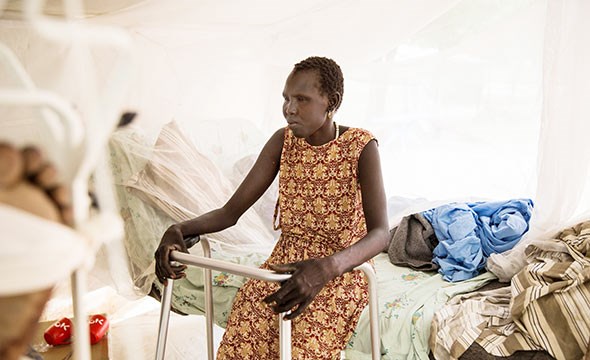 Bilde av kvinne med amputert ben sittende på syehussengen i feltsykehuset i Ganyliel Sør Sudan