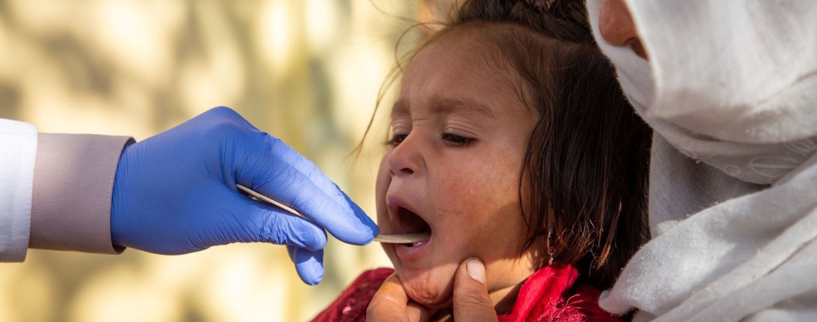 En liten jente blir undersøkt i munnen av en lege