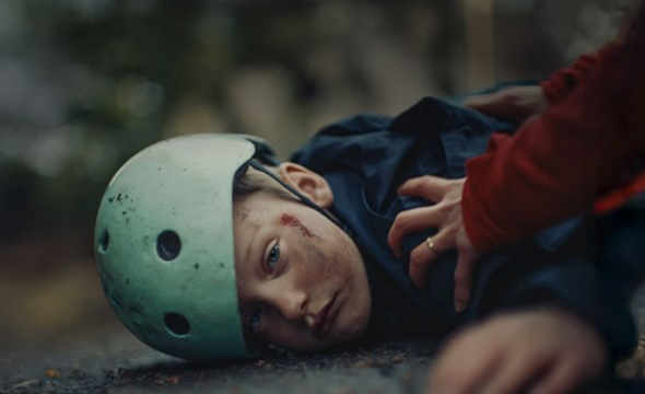 nærbilde av skadet gutt