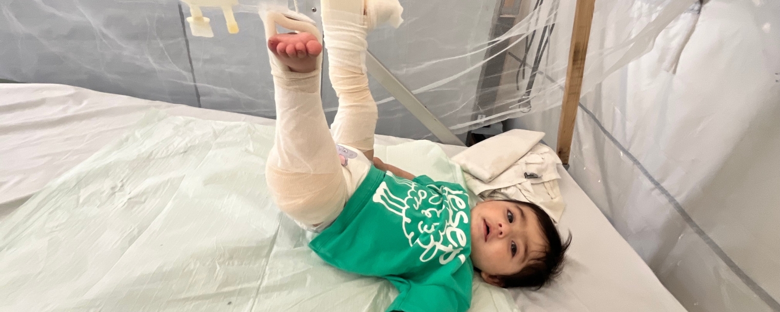 Et barn på 6 måneder ligger i en sykehusseng og har bandasjert føttene