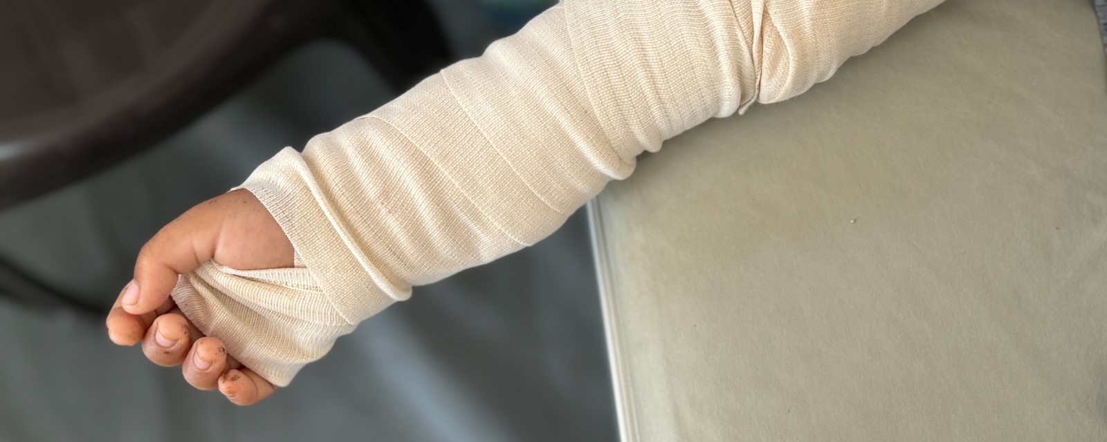 En skadet gutt ligger med armen bandasjert på et sykehus i Gaza.