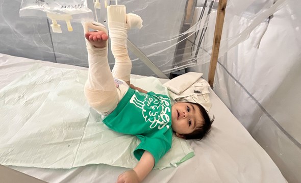 Barn med bandasje i ansiktet