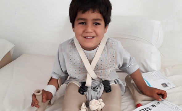 En gutt med proteser og krykker sitter i en seng og smiler