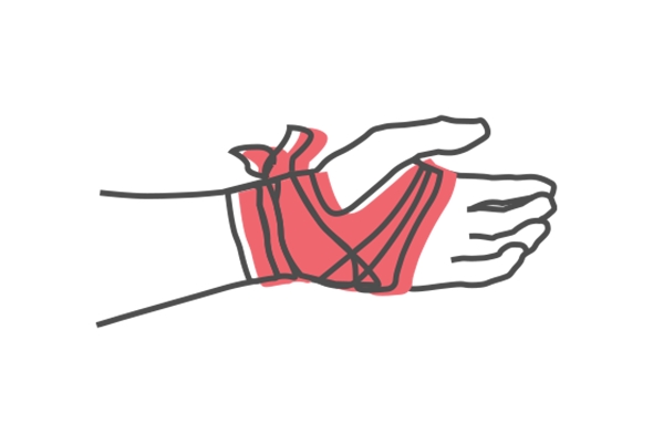 Illustrasjon blødende hånd