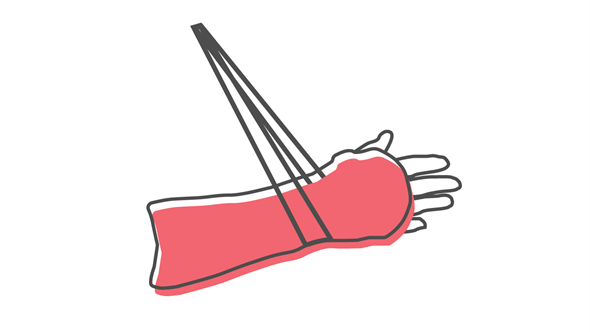 Illustrasjon - arm i fatle