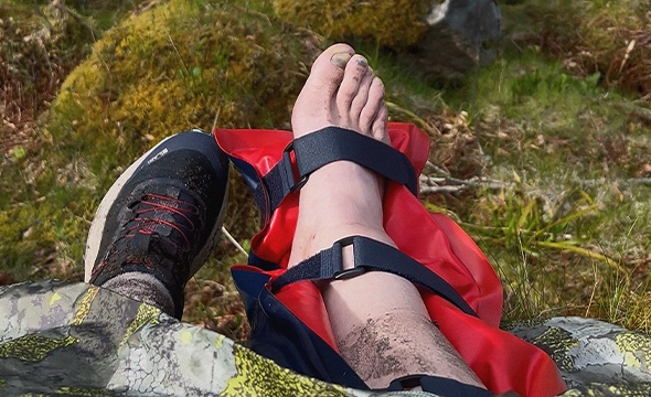 En skadet fot ligger på bakken og er bundet opp for å gi støtte og avlastning.